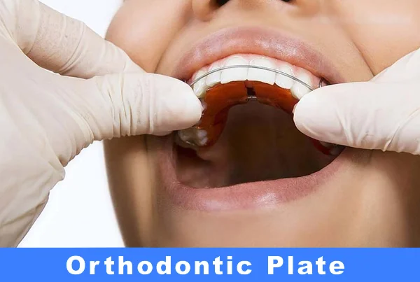 Removable Orthodontic Plate